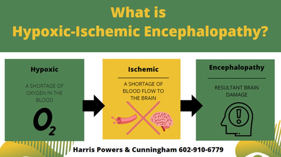Infograph: what is hypoxic ischemic encephalopathy