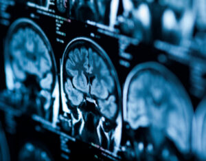brain scan